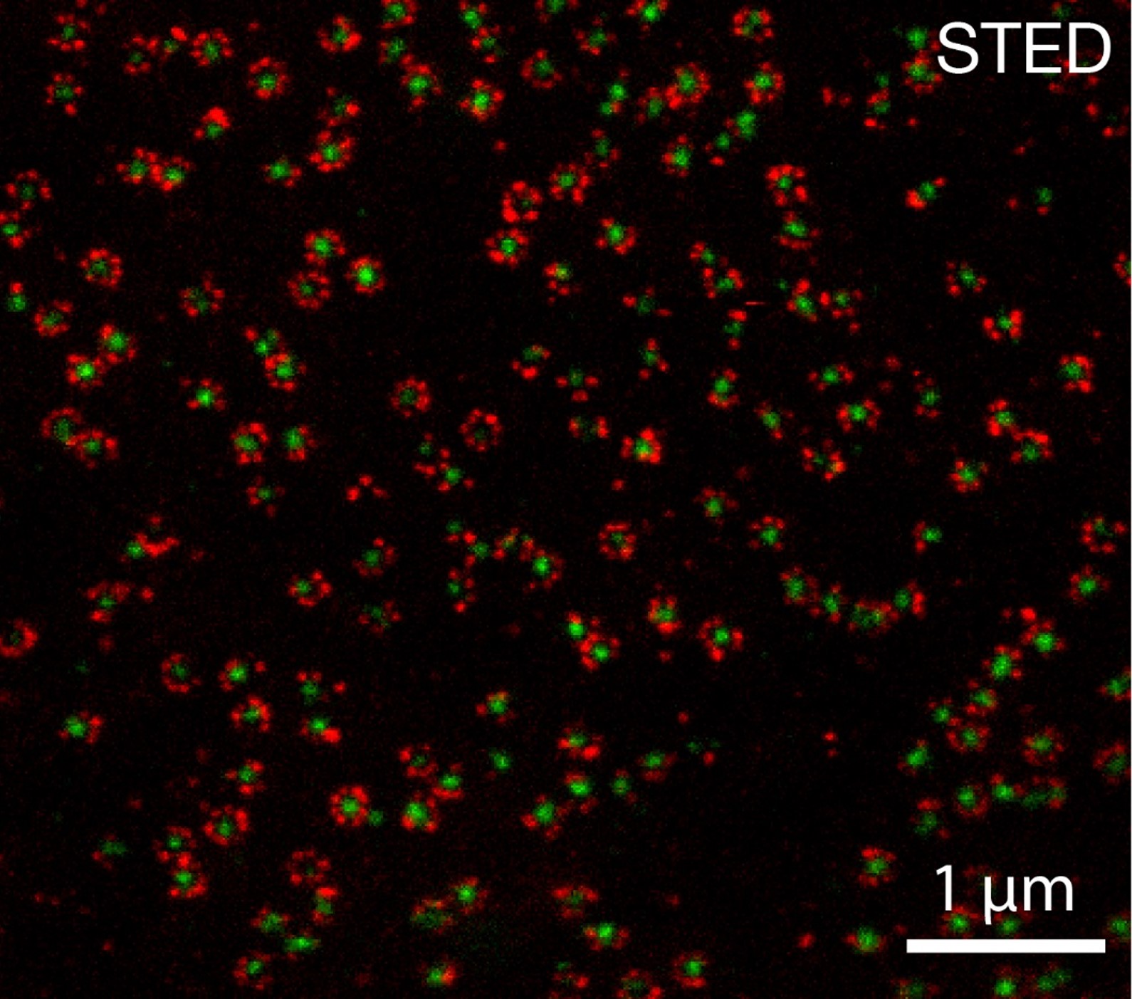 Nuclear pore by STED