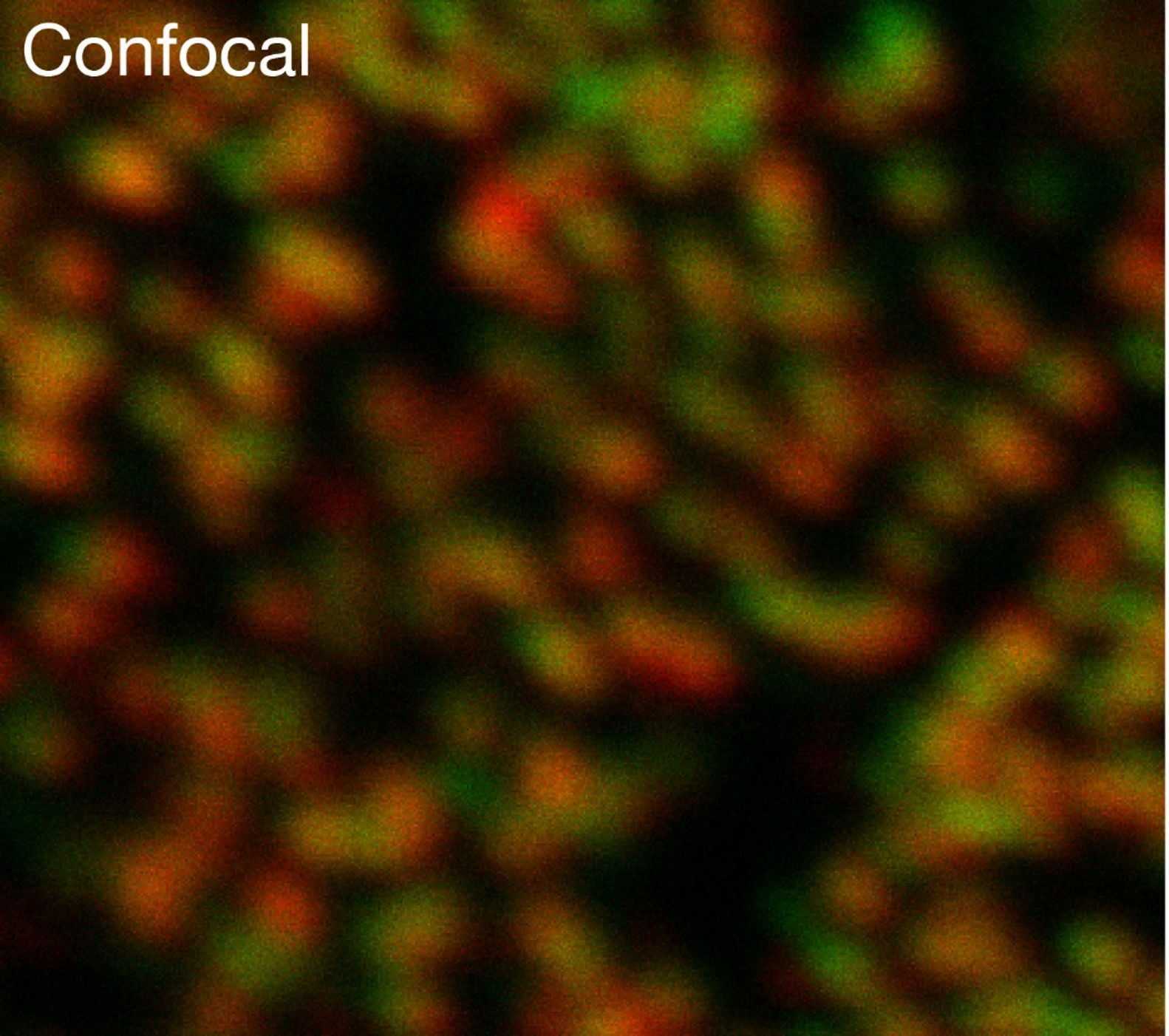 Nuclear pore by confocal